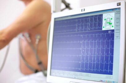 Die Wichtigkeit der EKG-Diagnostik im Rahmen von medizinischen Check-ups